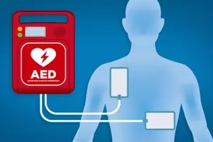 Automated External Defibrillators (AEDs): A Technical and Clinical Overview