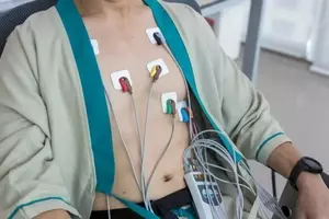 Holter Monitors: A Technical and Clinical Overview