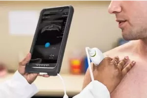 Portable Ultrasound Devices: A Technical and Clinical Overview
