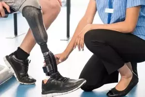Understanding Prosthetics: A Comprehensive Scientific Overview