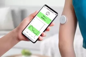 Understanding Continuous Glucose Monitoring (CGM): A Technical and Physiological Overview