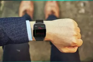 Smart ECG Watch: A Scientific Overview