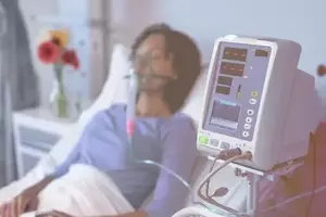 Mechanical Ventilators: A Neutral Overview of Concepts, Mechanisms, and Clinical Context