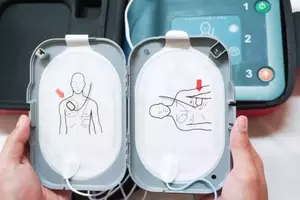 External Defibrillator: A Neutral Scientific Overview of Principles, Mechanisms