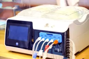 Dialysis Machines: Principles, Mechanisms, Clinical Applications, and Perspectives