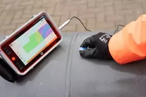 Ultrasound Equipment: Principles, Functions, and Clinical Applications