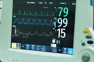 Electrocardiographic Monitors: What They Are, How They Work, and What the Evidence Shows