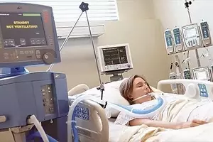 Mechanical Ventilators: Principles, Functions, and Clinical Contexts