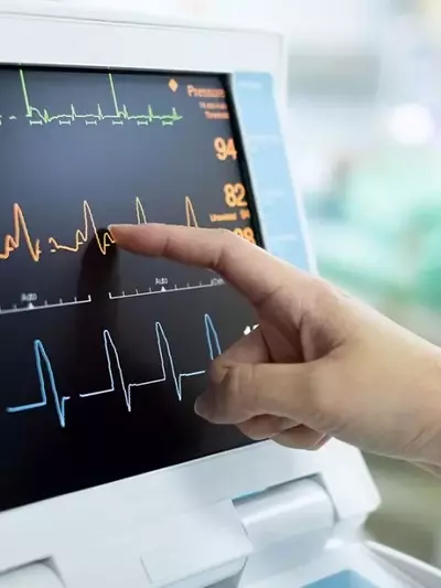 Electrocardiograph: Structure, Function, and Clinical Interpretation