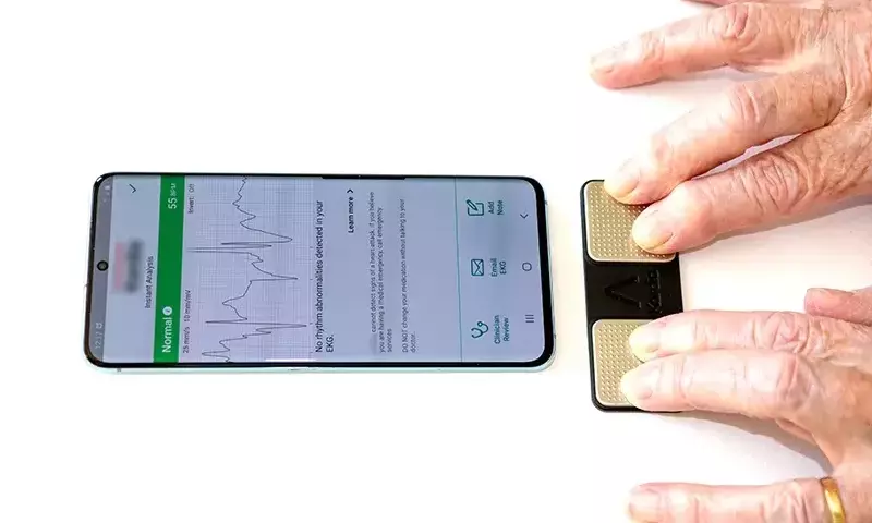 Home Electrocardiogram Devices: A Guide to Understanding Personal Heart Monitoring Technology