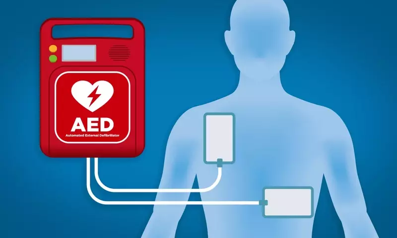 Automated External Defibrillators (AEDs): A Technical and Clinical Overview