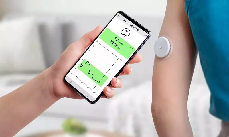 Understanding Continuous Glucose Monitoring (CGM): A Technical and Physiological Overview