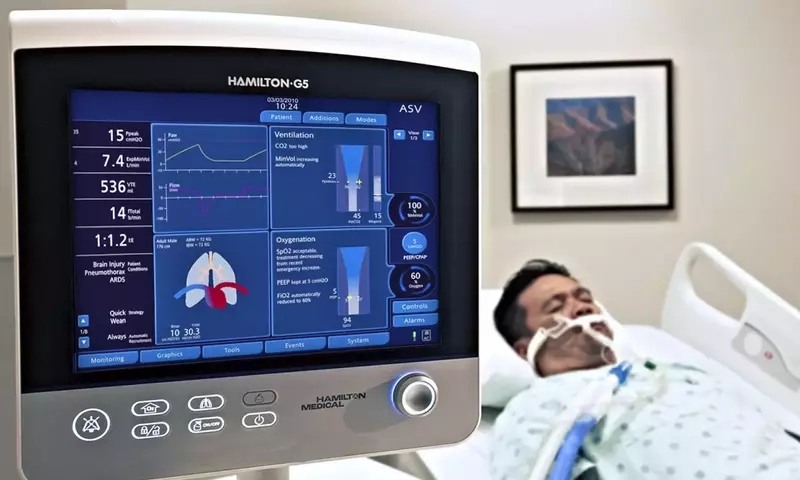 Mechanical Ventilators: A Scientific Overview of Principles, Functions, and Clinical Context