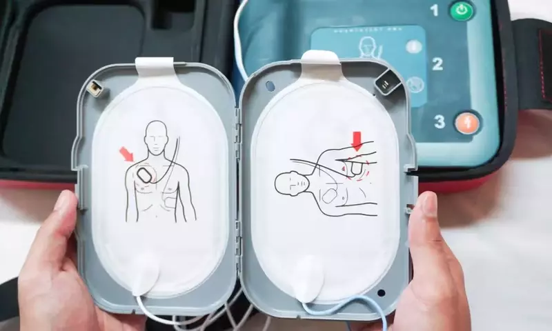 External Defibrillator: A Neutral Scientific Overview of Principles, Mechanisms