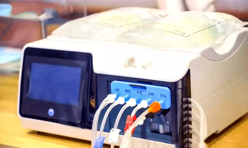 Dialysis Machines: Principles, Mechanisms, Clinical Applications, and Perspectives