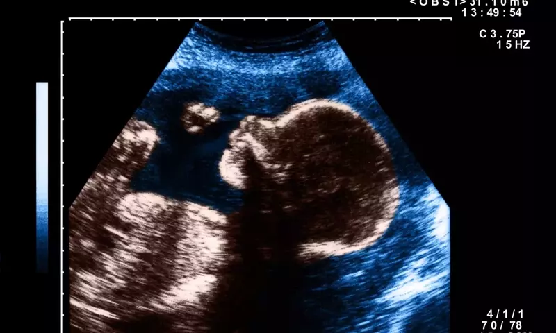 The Art and Impact of Pregnancy Nicknames