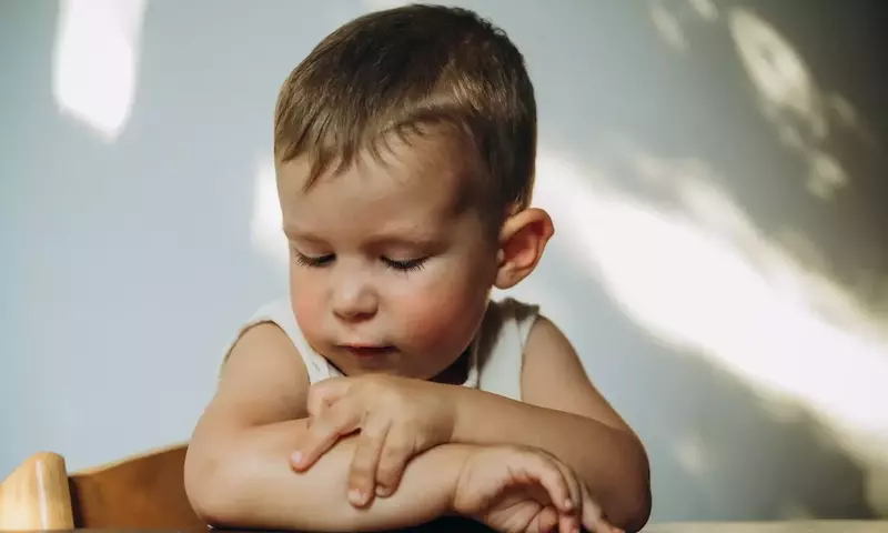 Understanding and Managing Eczema in Children