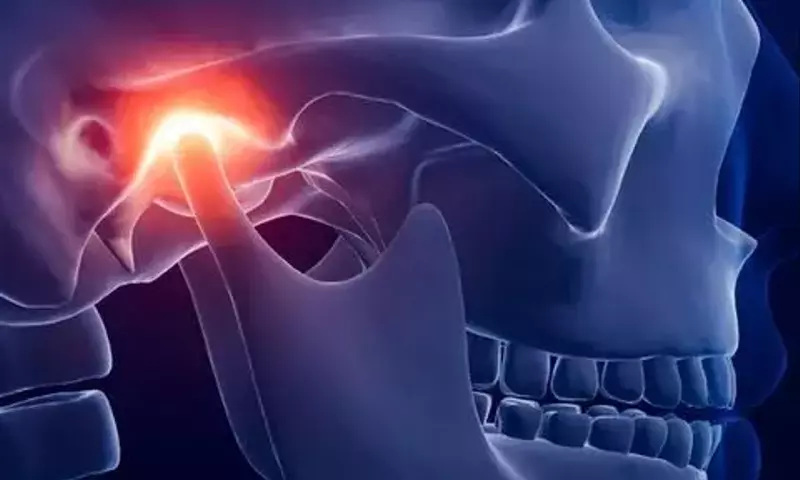 Kiefergelenksprobleme: Diagnose und wirksame Behandlung bei CMD